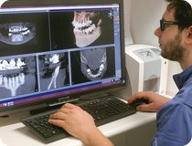 TAC cone beam 3D dentiste