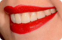 mon sourire a un secret