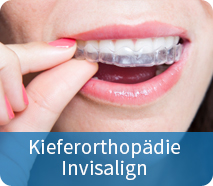 invisalign