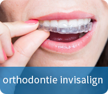 invisalign