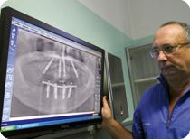 radiographie panoramique numérique